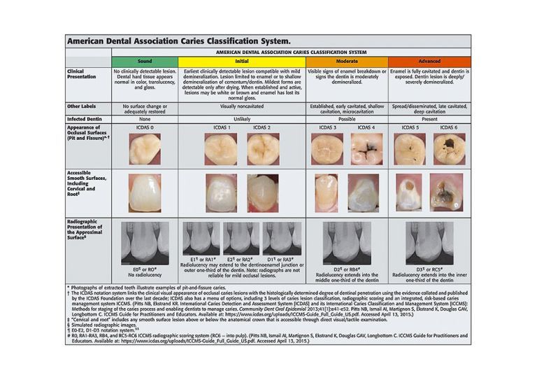 American Dental Association caries classification system.